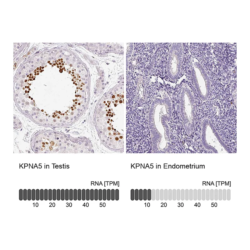 Atlas Antibodies Anti-KPNA5 Antibody