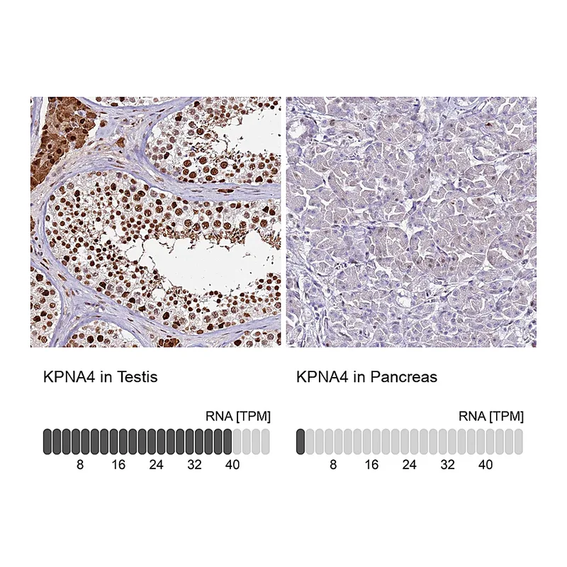 Atlas Antibodies Anti-KPNA4 Antibody