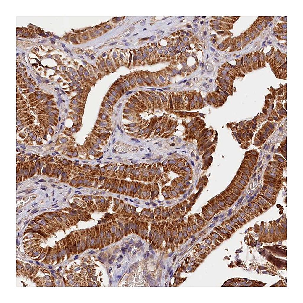 Atlas Antibodies Anti-KPTN Antibody