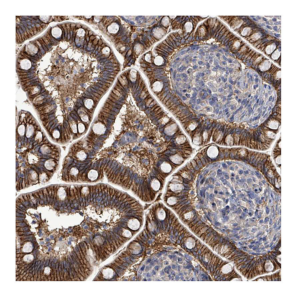 Atlas Antibodies Anti-KRAS Antibody