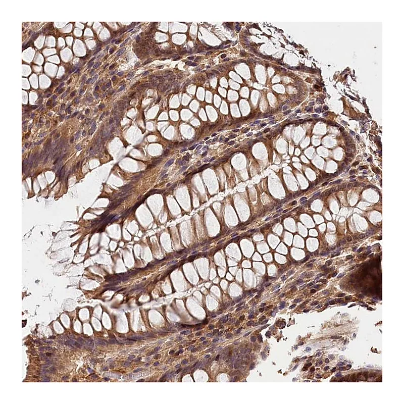 Atlas Antibodies Anti-KPTN Antibody