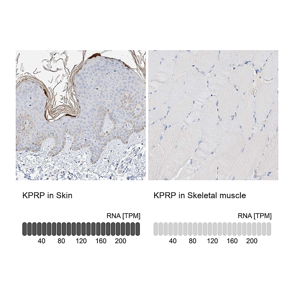 Atlas Antibodies Anti-KPRP Antibody