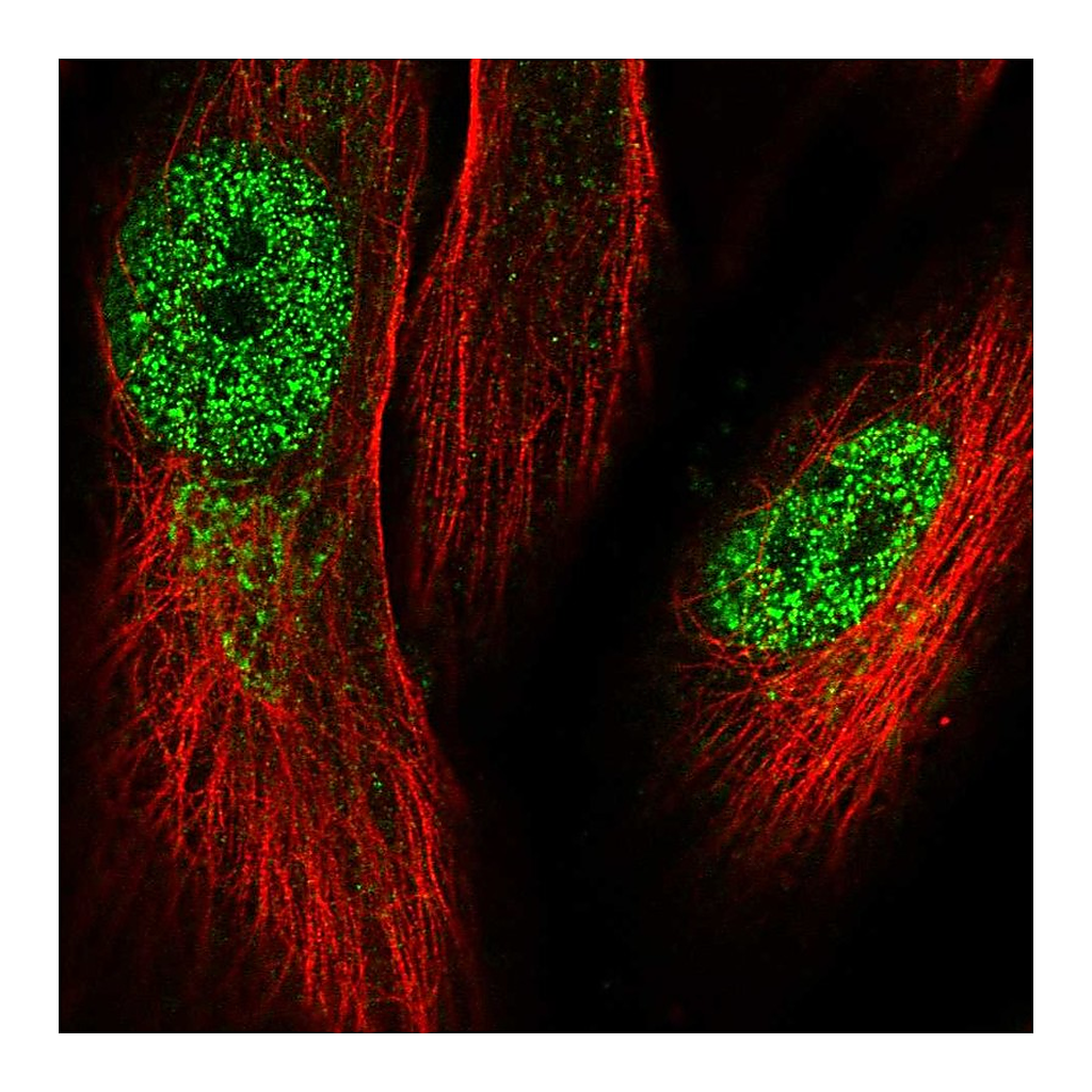 Atlas Antibodies Anti-KRBOX1 Antibody