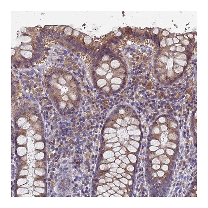 Atlas Antibodies Anti-KRCC1 Antibody