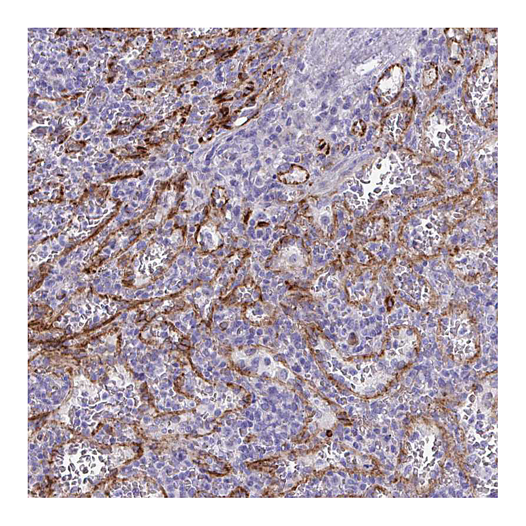 Atlas Antibodies Anti-KRIT1 Antibody