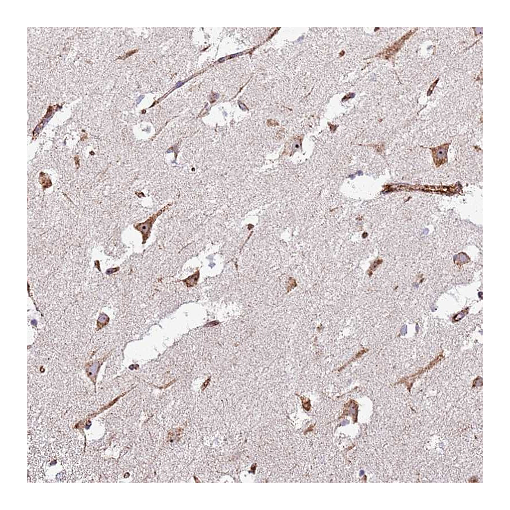Atlas Antibodies Anti-KRI1 Antibody