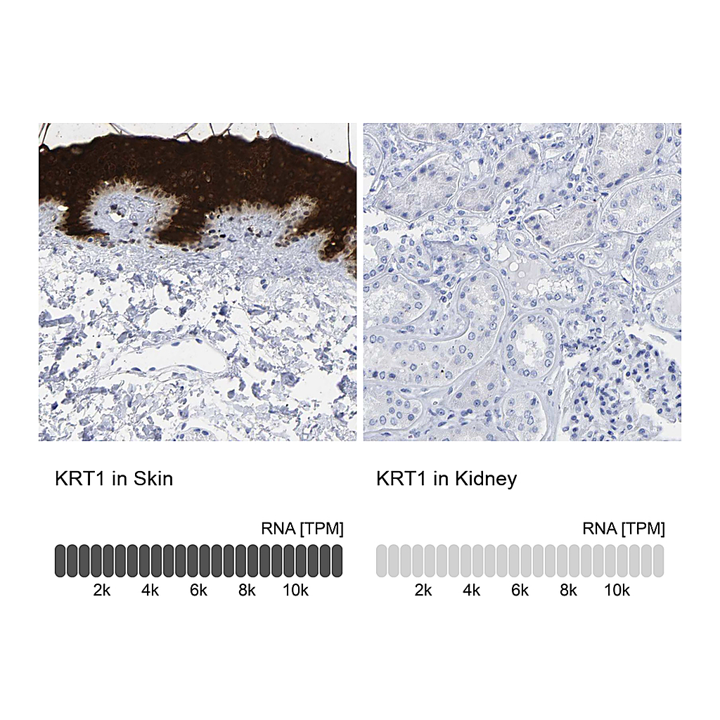 Atlas Antibodies Anti-KRT1 Antibody