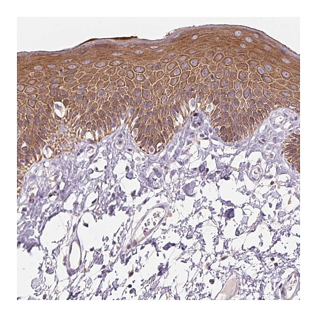 Atlas Antibodies Anti-KRT1 Antibody