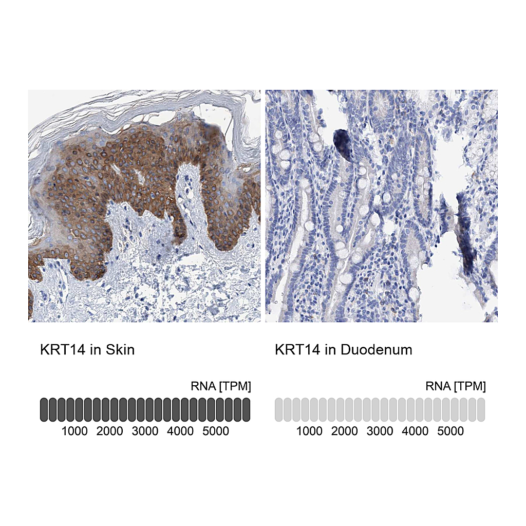 Atlas Antibodies Anti-KRT14 Antibody