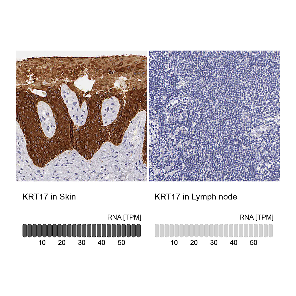 Atlas Antibodies Anti-KRT17 Antibody