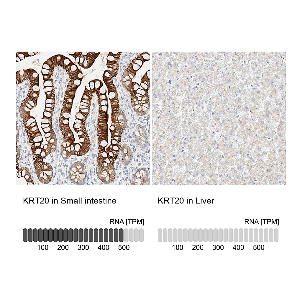 Atlas Antibodies Anti-KRT20 Antibody