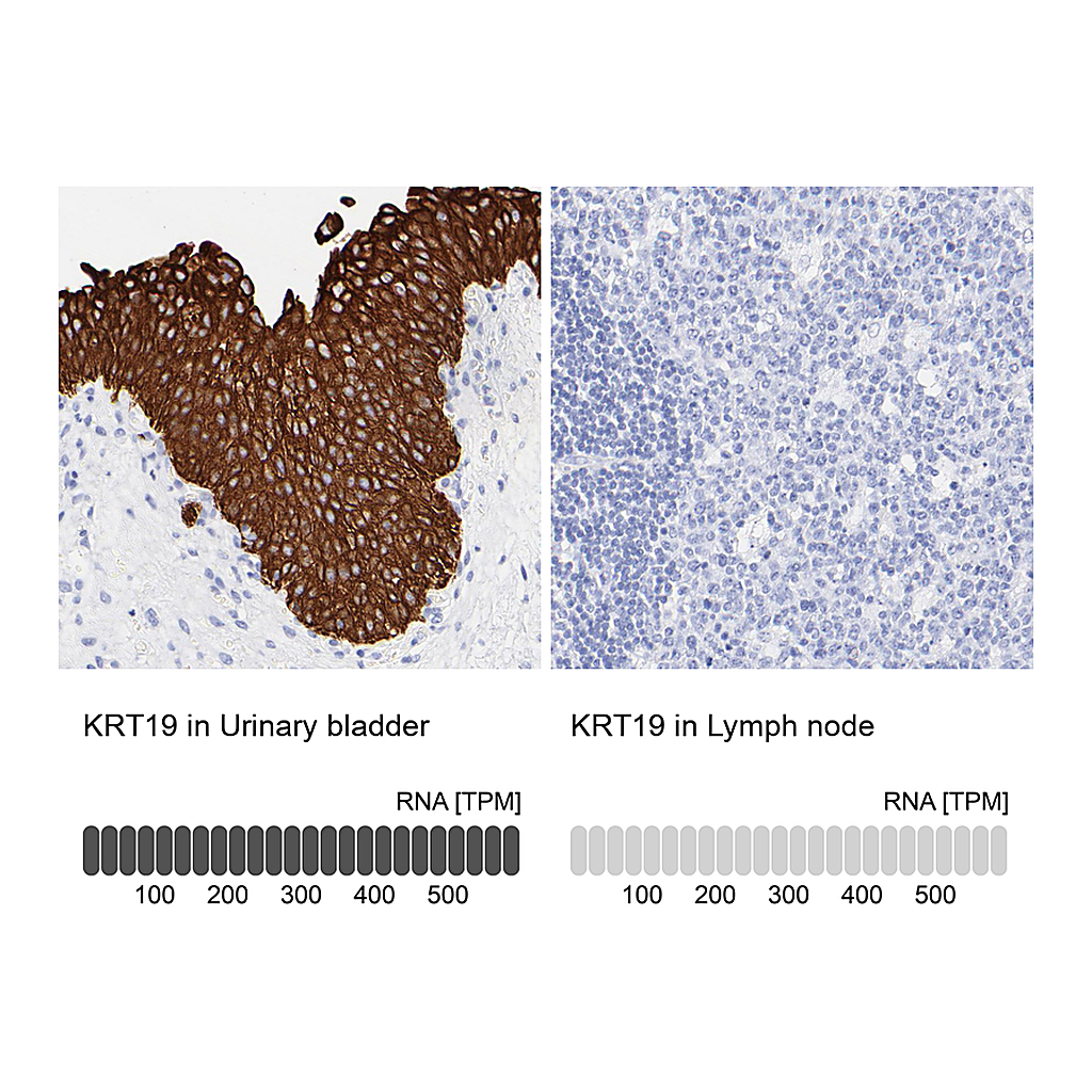 Atlas Antibodies Anti-KRT19 Antibody