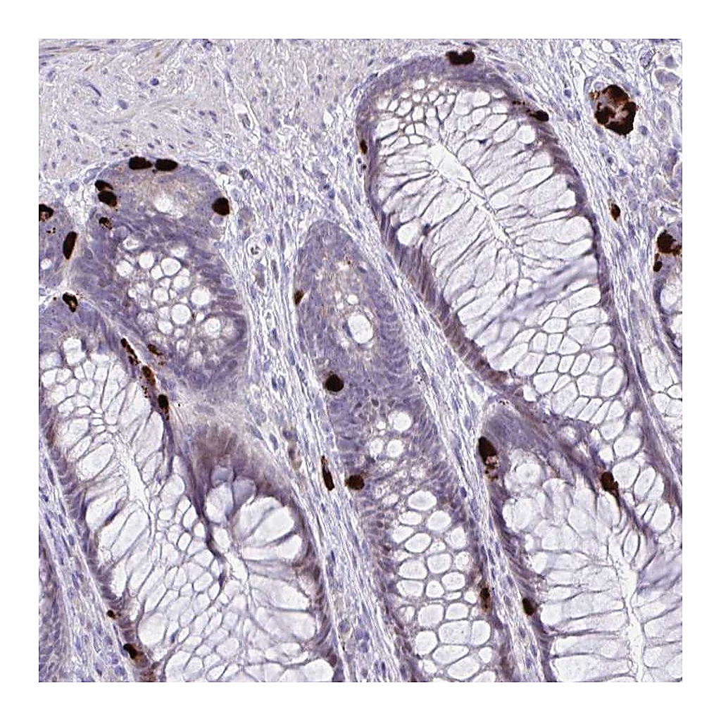 Atlas Antibodies Anti-KRT222 Antibody