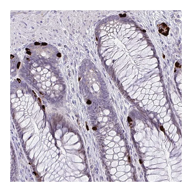 Atlas Antibodies Anti-KRT222 Antibody