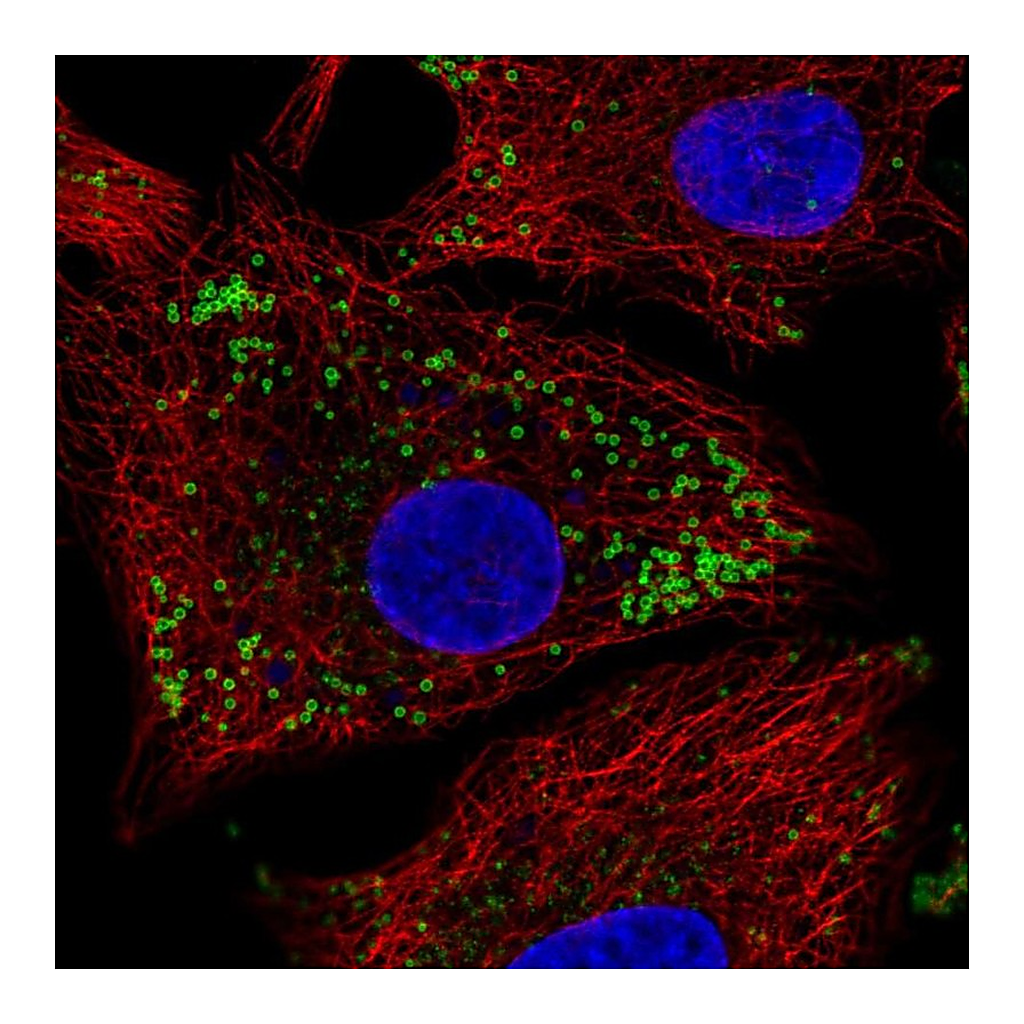 Atlas Antibodies Anti-KRT222 Antibody