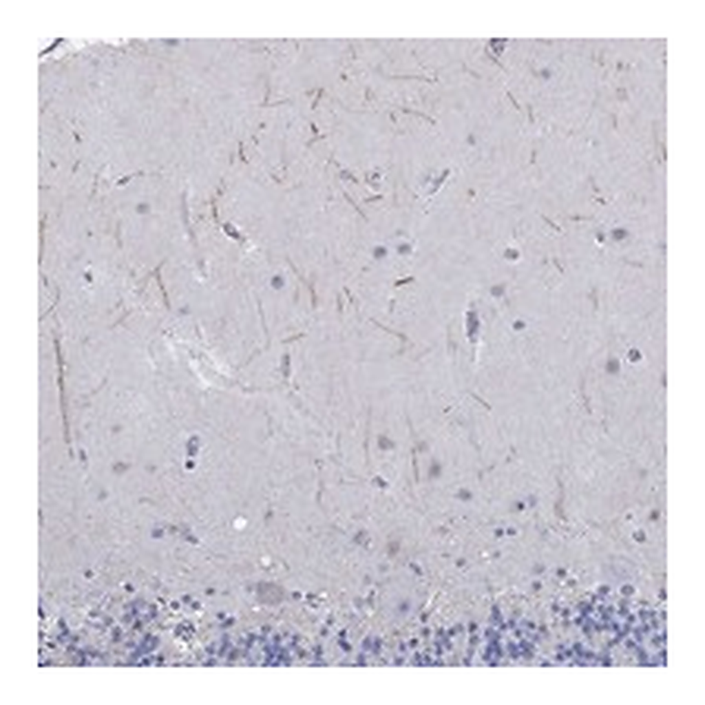 Atlas Antibodies Anti-KRT222 Antibody