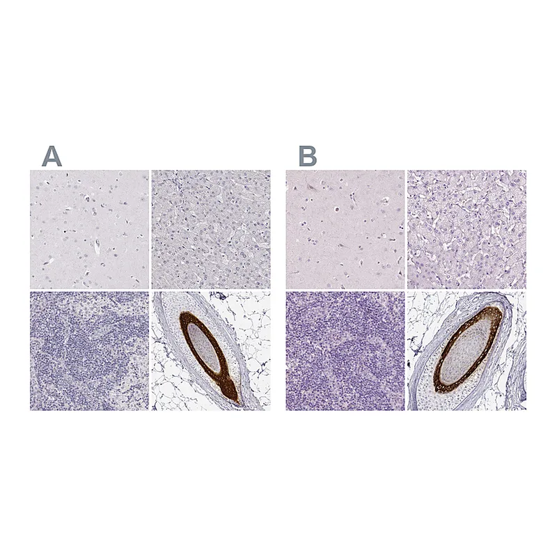 Atlas Antibodies Anti-KRT25 Antibody