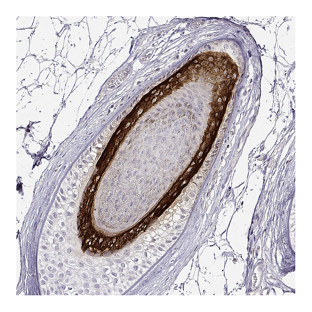 Atlas Antibodies Anti-KRT25 Antibody