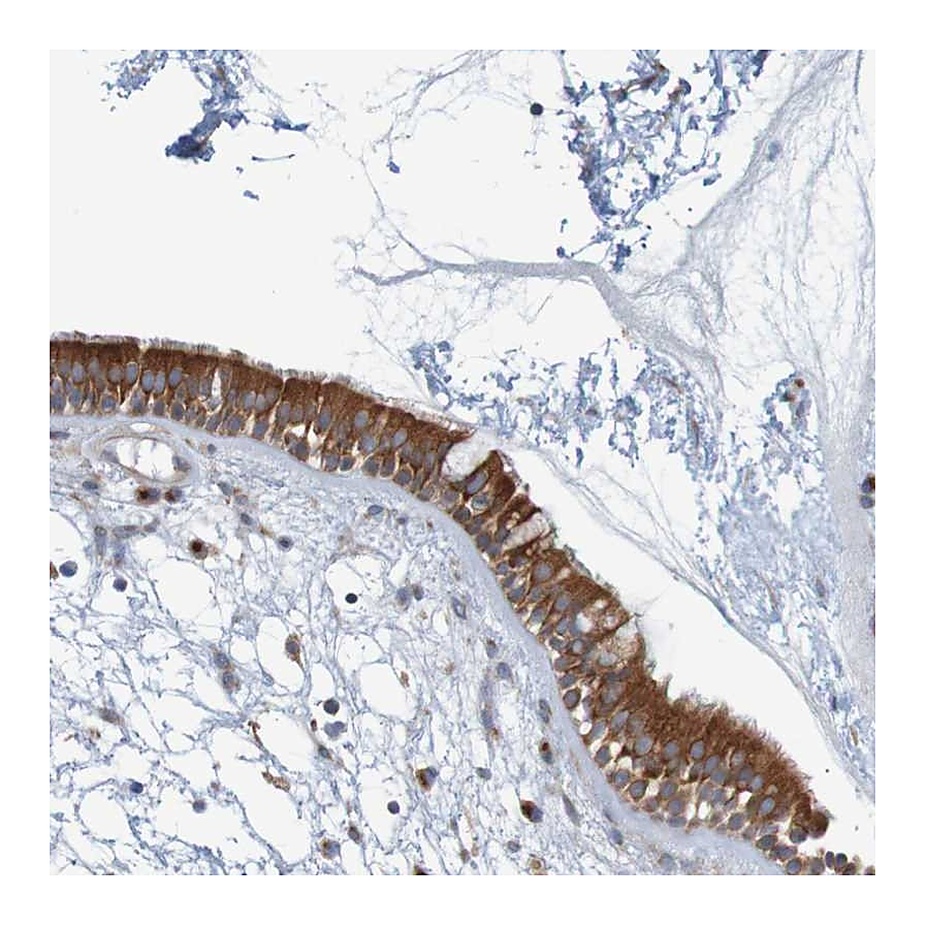 Atlas Antibodies Anti-KRT23 Antibody