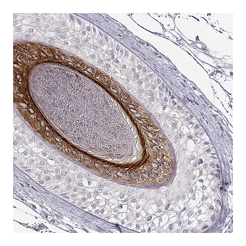 Atlas Antibodies Anti-KRT26 Antibody