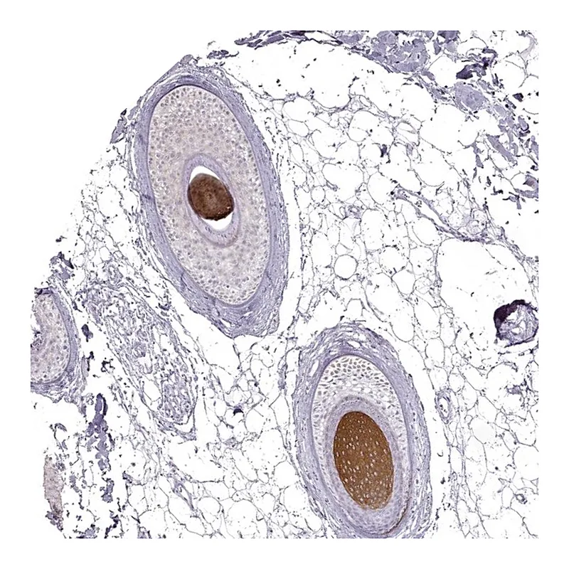 Atlas Antibodies Anti-KRT31 Antibody