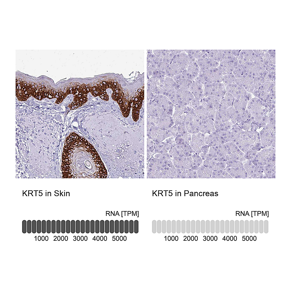 Atlas Antibodies Anti-KRT5 Antibody