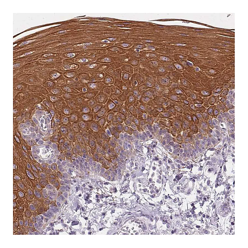 Atlas Antibodies Anti-KRT6A Antibody