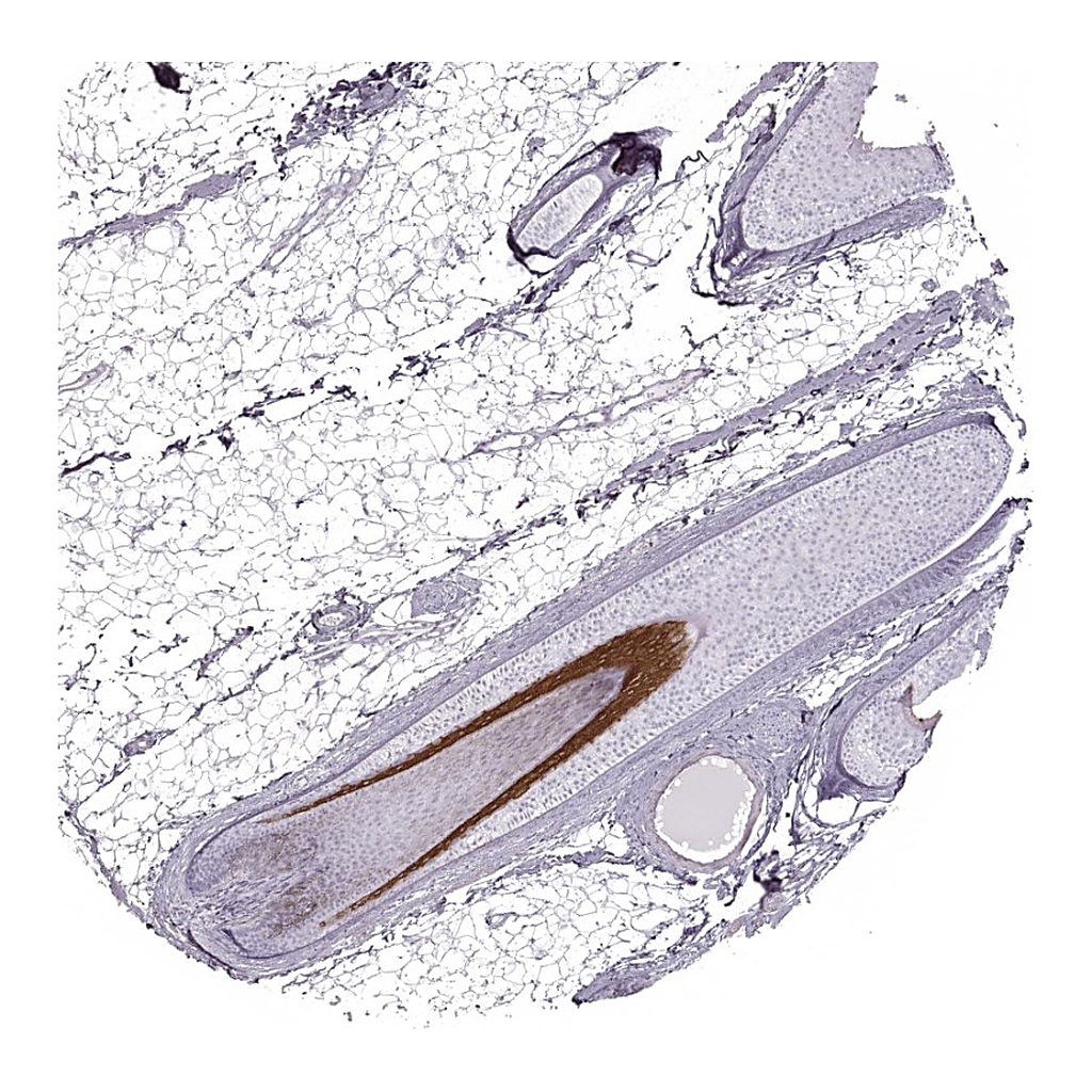 Atlas Antibodies Anti-KRT74 Antibody