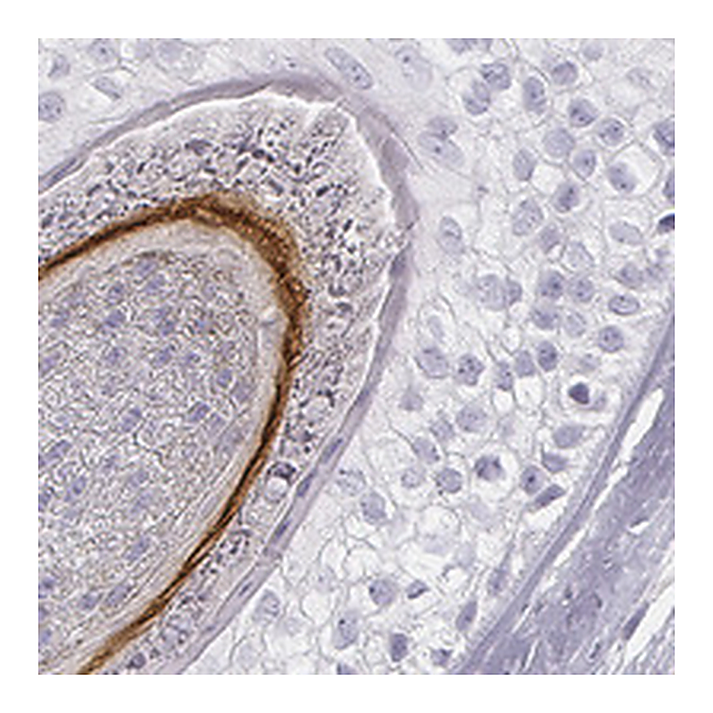 Atlas Antibodies Anti-KRT72 Antibody