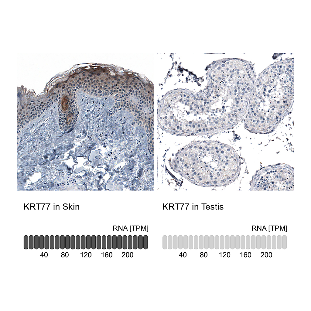 Atlas Antibodies Anti-KRT77 Antibody