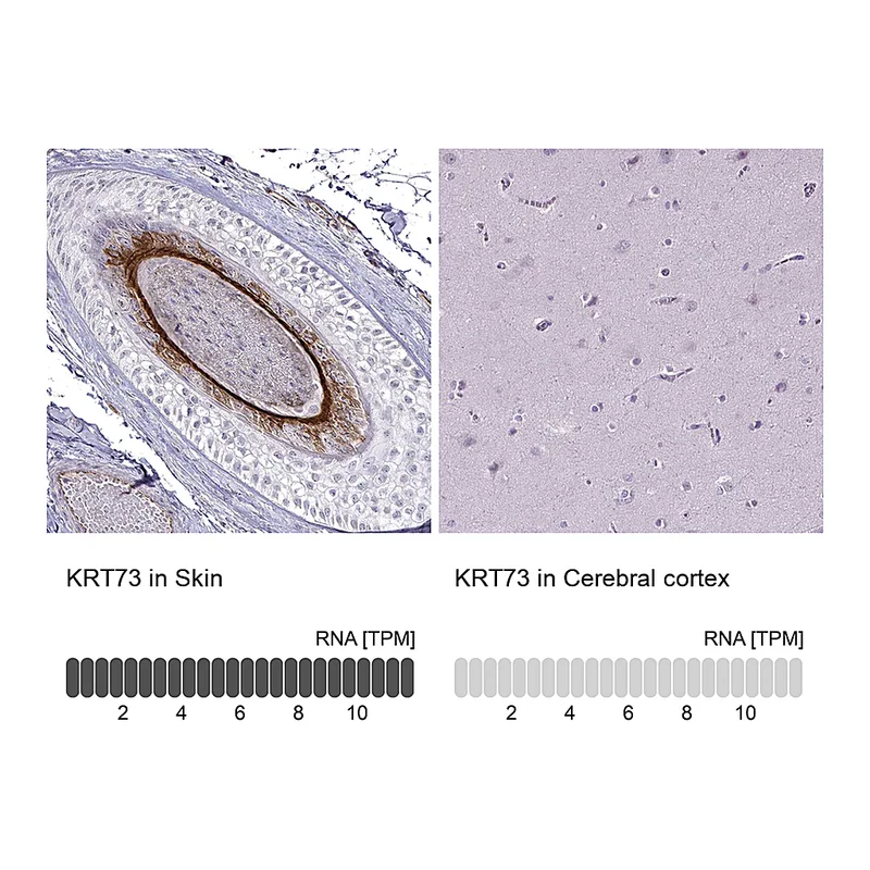 Atlas Antibodies Anti-KRT73 Antibody