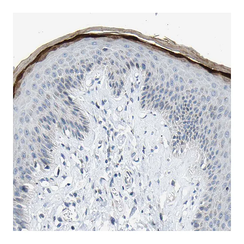 Atlas Antibodies Anti-KRT76 Antibody