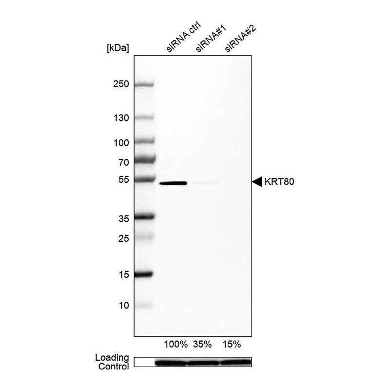 Atlas Antibodies Anti-KRT80 Antibody