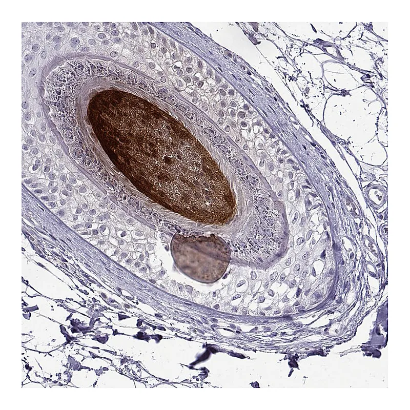 Atlas Antibodies Anti-KRTAP11-1 Antibody