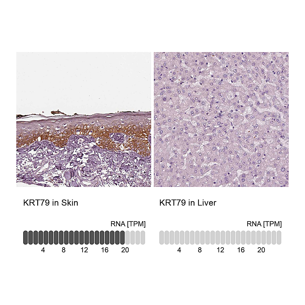 Atlas Antibodies Anti-KRT79 Antibody