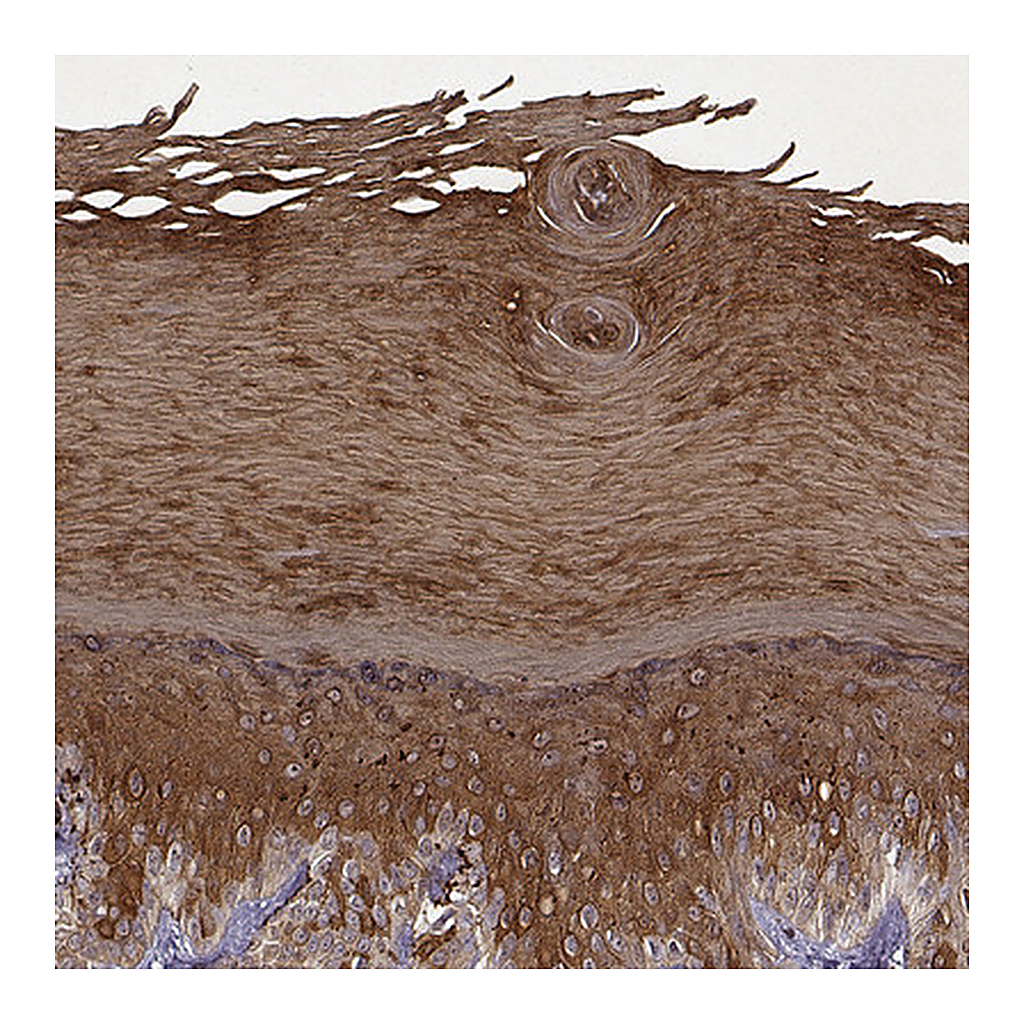 Atlas Antibodies Anti-KRT9 Antibody