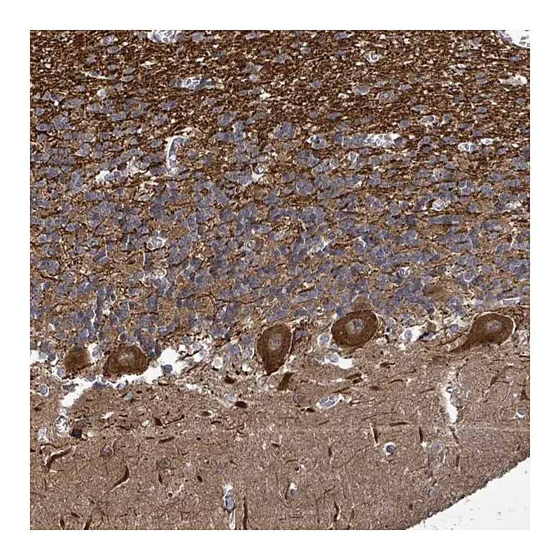 Atlas Antibodies Anti-KRTAP27-1 Antibody