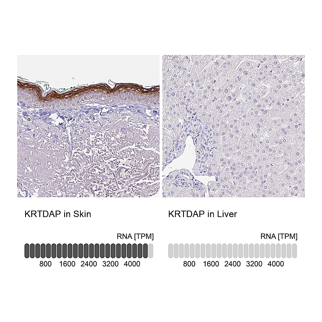 Atlas Antibodies Anti-KRTDAP Antibody