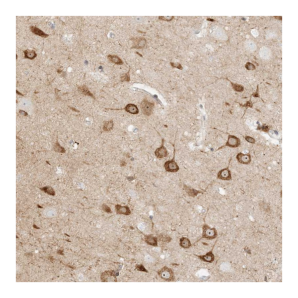 Atlas Antibodies Anti-KSR2 Antibody
