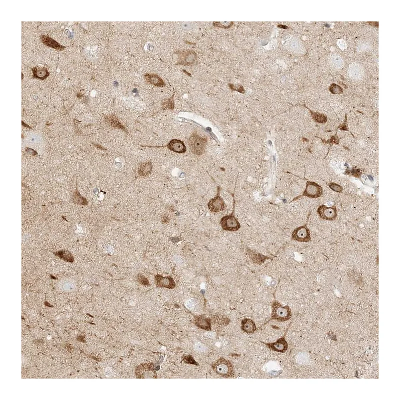 Atlas Antibodies Anti-KSR2 Antibody