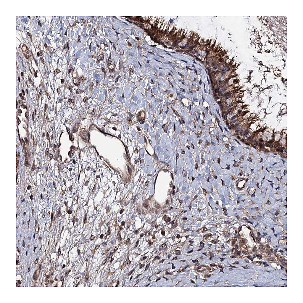 Atlas Antibodies Anti-KXD1 Antibody