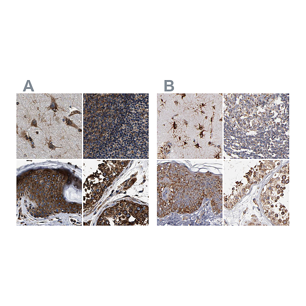 Atlas Antibodies Anti-KTN1 Antibody