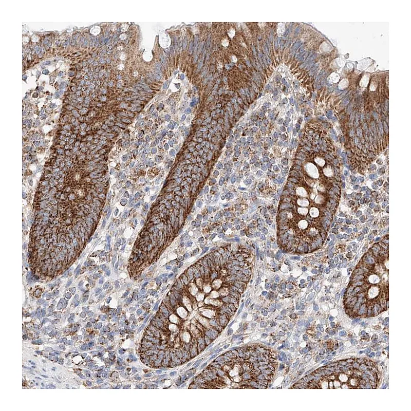 Atlas Antibodies Anti-KTI12 Antibody