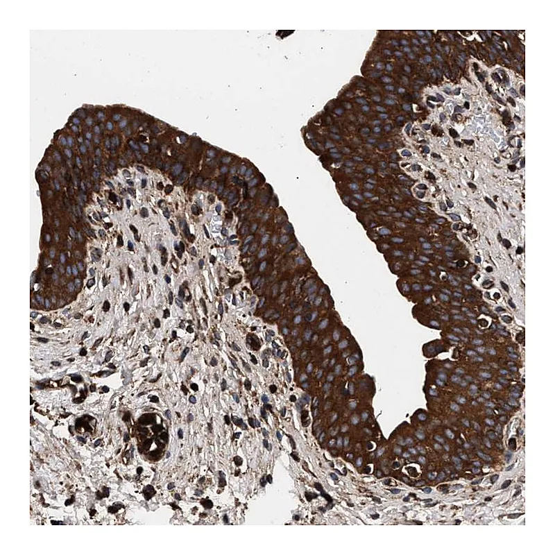 Atlas Antibodies Anti-KYAT1 Antibody