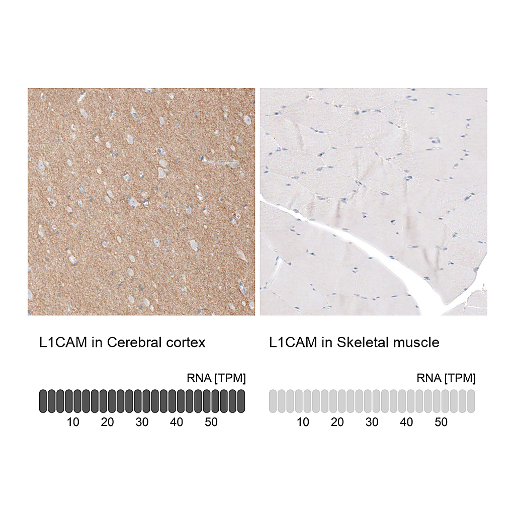 Atlas Antibodies Anti-L1CAM Antibody