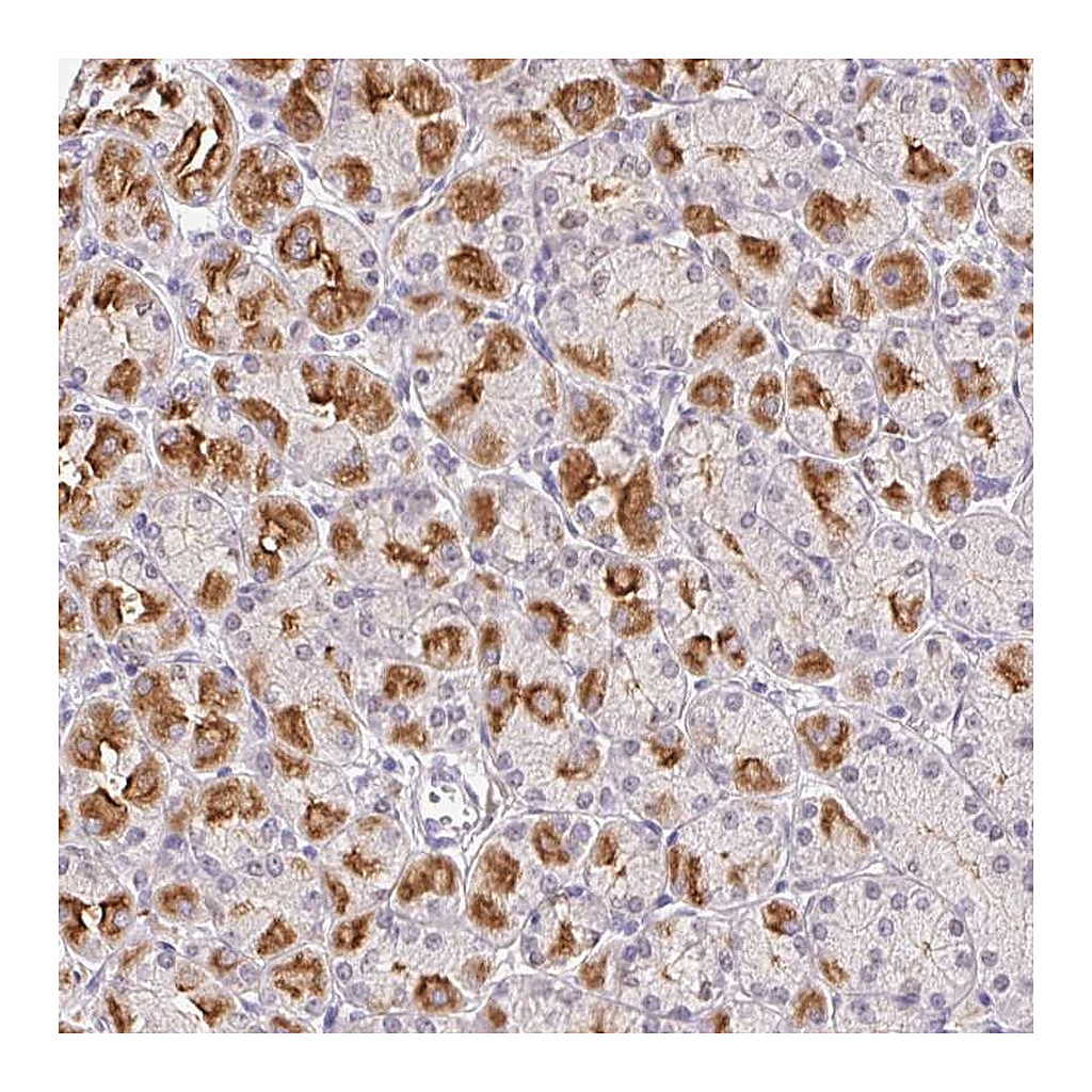 Atlas Antibodies Anti-L3MBTL4 Antibody
