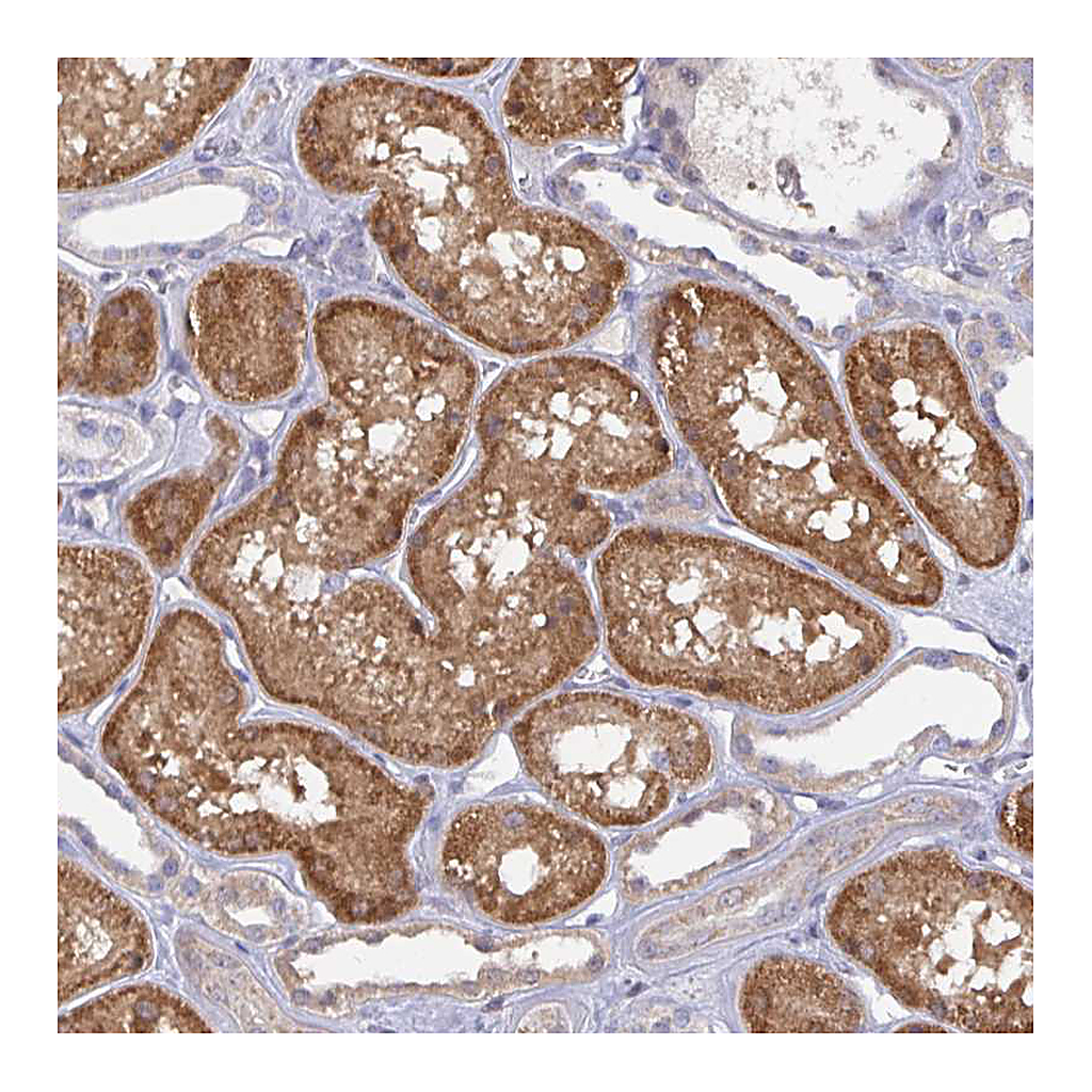 Atlas Antibodies Anti-L3HYPDH Antibody