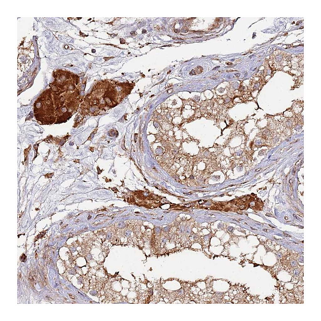 Atlas Antibodies Anti-LACC1 Antibody