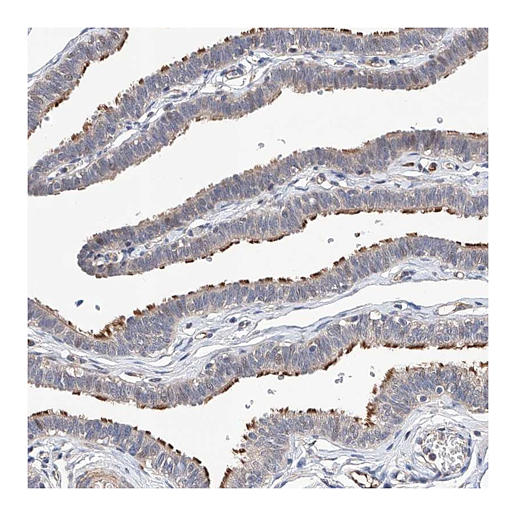 Atlas Antibodies Anti-LACE1 Antibody