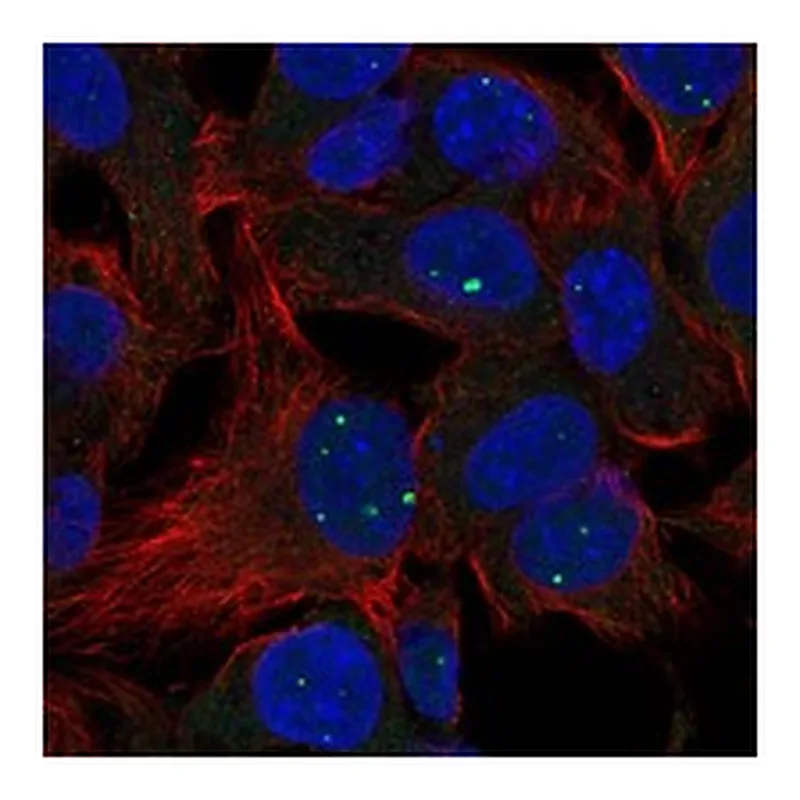 Atlas Antibodies Anti-LACTBL1 Antibody
